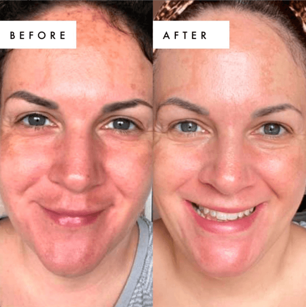 Beauty Pie Dr Glycolic UGC before and after