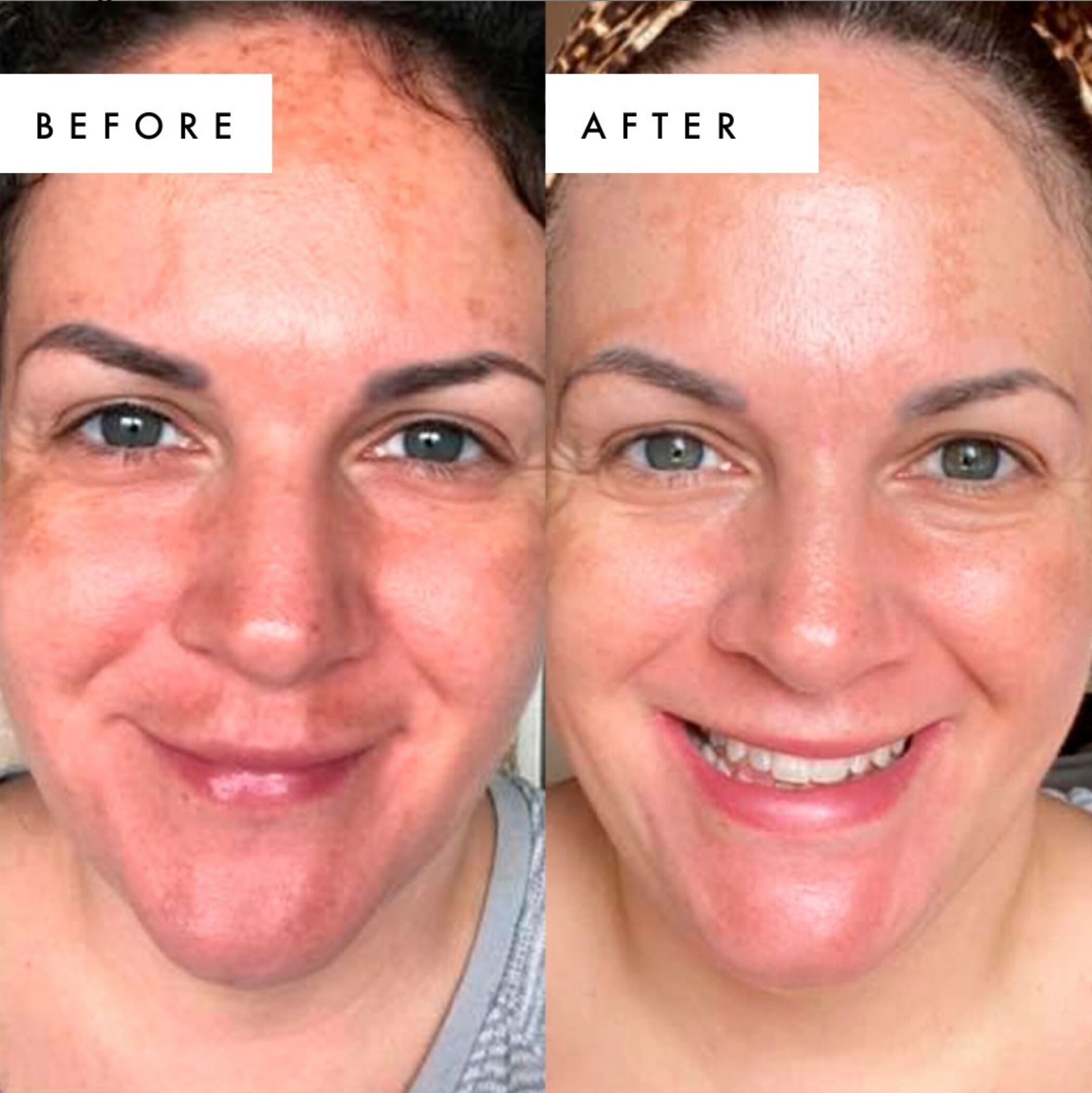 before-after-dr-glycolic.jpg Beauty Pie Dr Glycolic UGC before and after