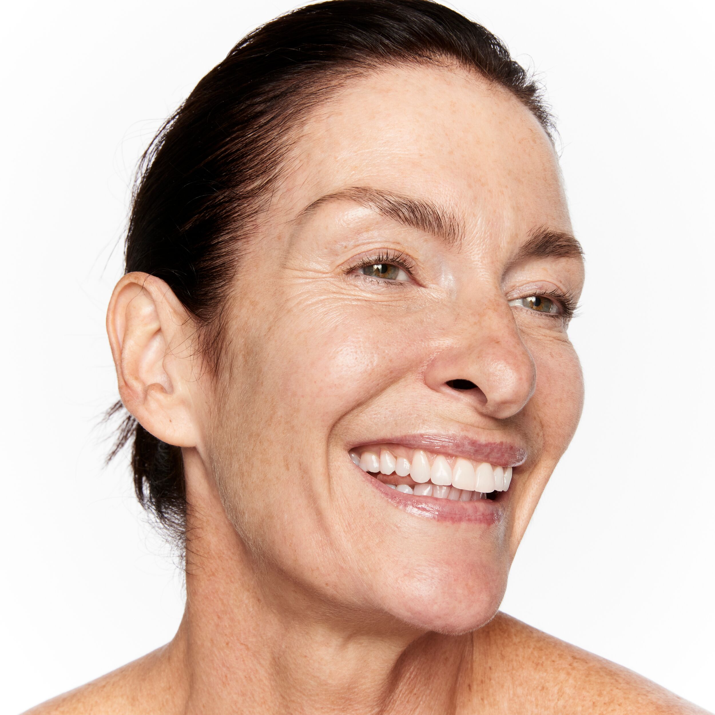 How to treat Rosacea How to treat Rosacea