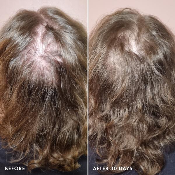 BP10800_RENEWED_DENSITY_HAIR_CAPSULES_PDP_2_WEB