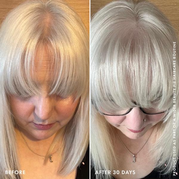 BP10800_RENEWED_DENSITY_HAIR_TREATMENT_PDP_WEB
