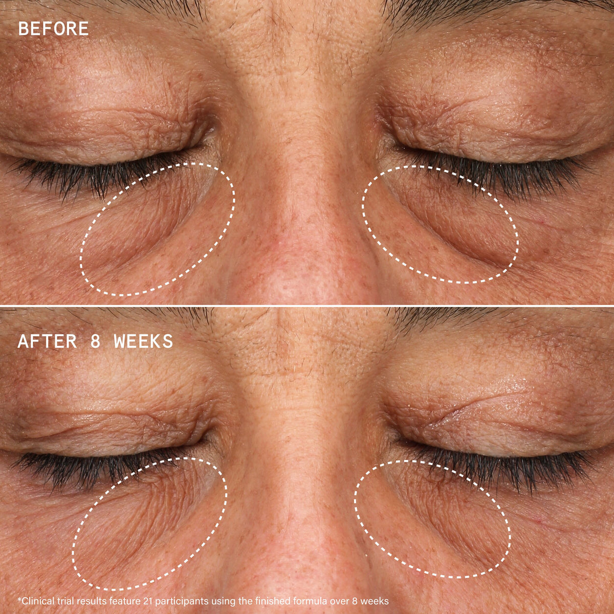 SUPER HEALTHY SKIN UBER YOUTH EYE ENERGY CREAM__PDP_ECOM_1:1_B&A1_2026_WEB