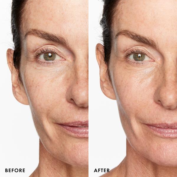 superluminous_serum_concealer_medium_70869_CSL_model_before_after_WEB